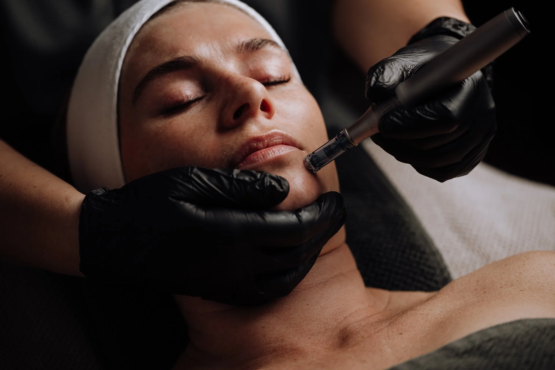Person receiving microneedling