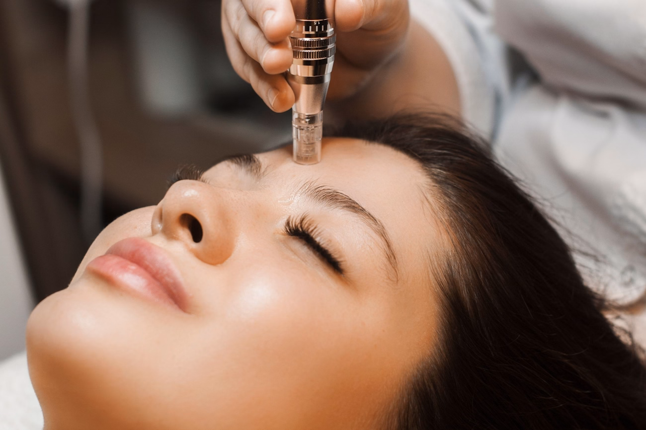 Person receiving microneedling